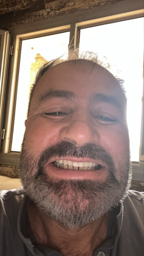 صورة توضيحية للحالة